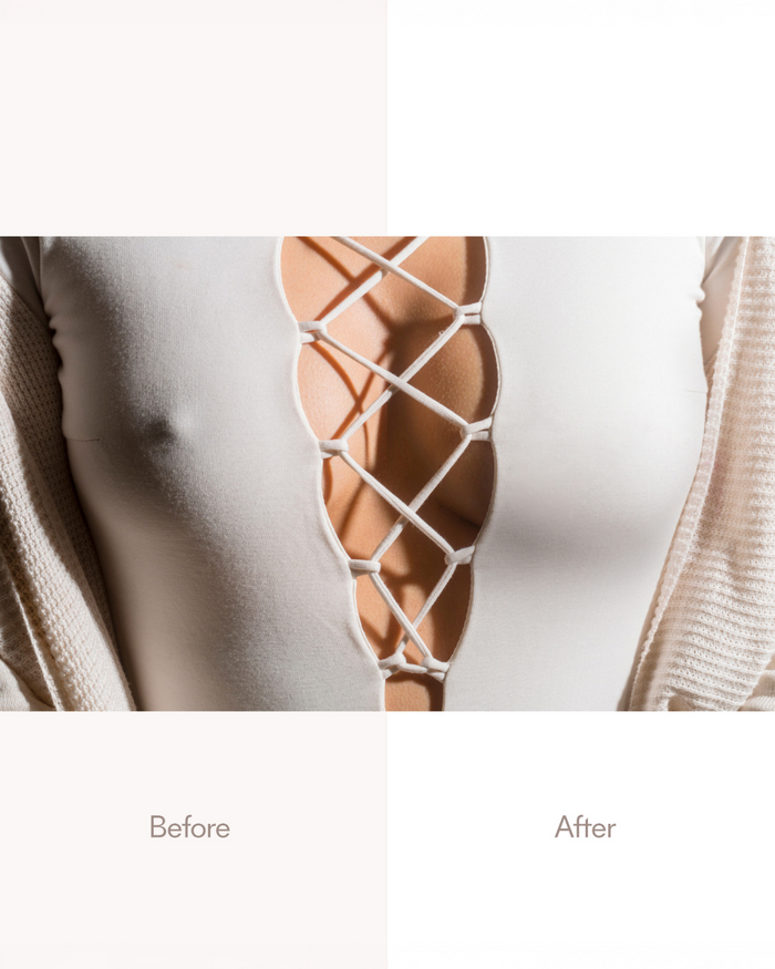 | Before and After | General